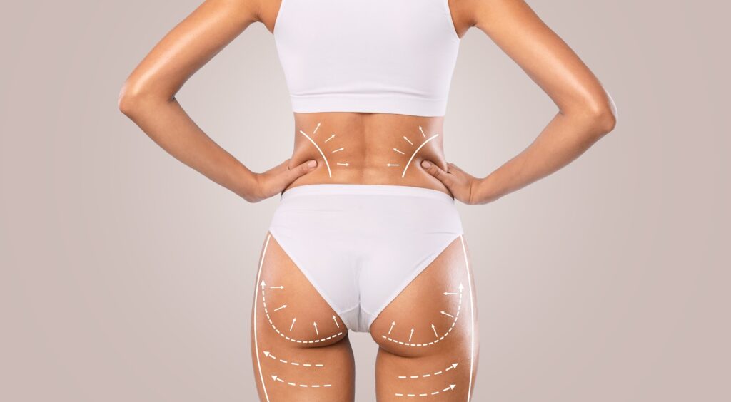 Woman's buttocks with lifted areas